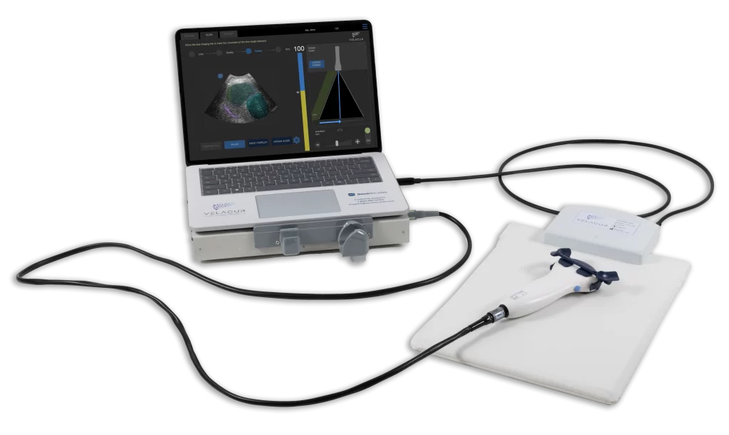 Equipo Fibroscan